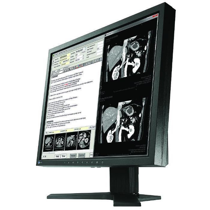 Medical monitor EIZO RadiForce MX194 1MP Color