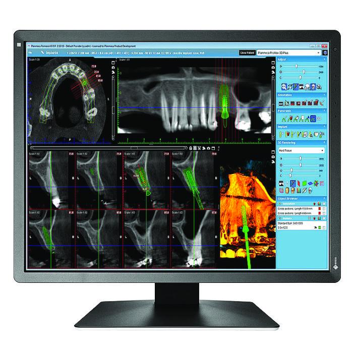 Medical monitor EIZO RadiForce MX216-SB 2MP Color