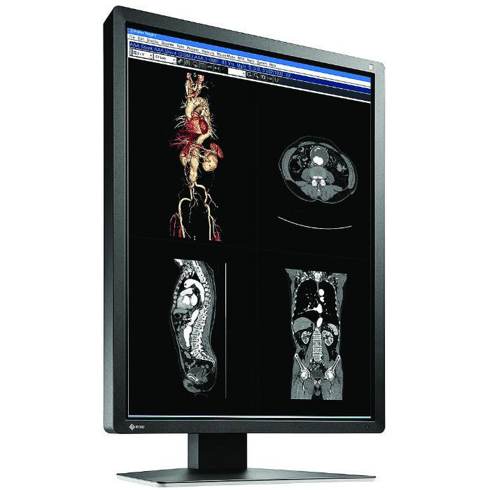 Medical monitor EIZO RadiForce MX216-SB 2MP Color