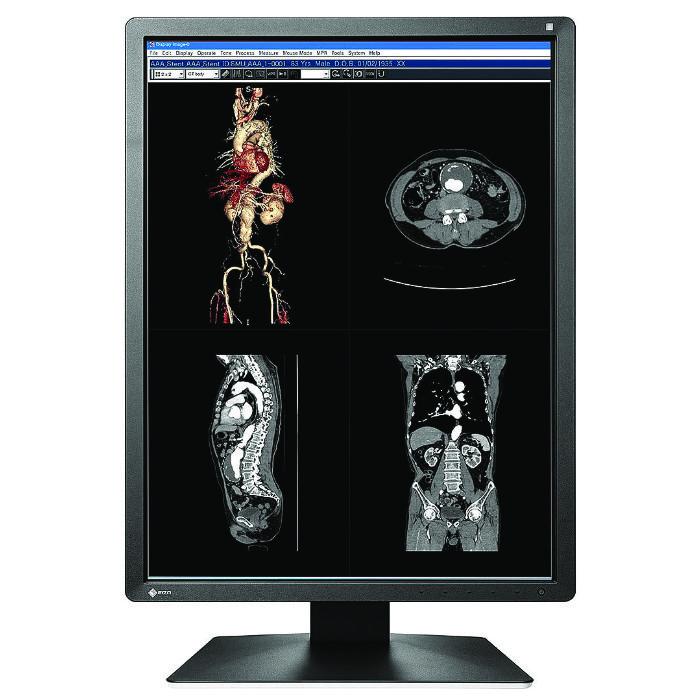 Medical monitor EIZO RadiForce MX216-SB 2MP Color