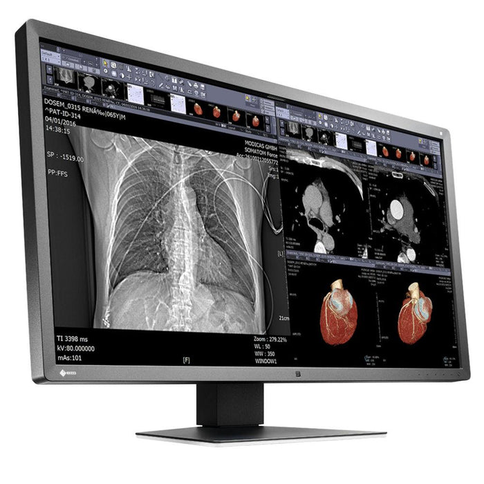 Medical monitor EIZO RadiForce MX315W 8MP Color