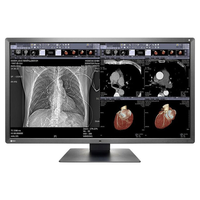 Medical monitor EIZO RadiForce MX315W 8MP Color