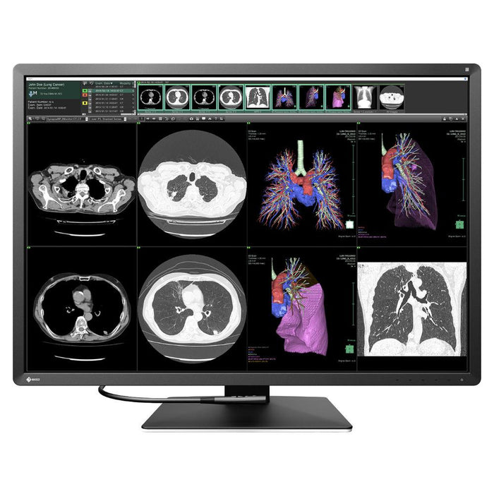 Medical monitor EIZO RadiForce RX1270 12MP Color
