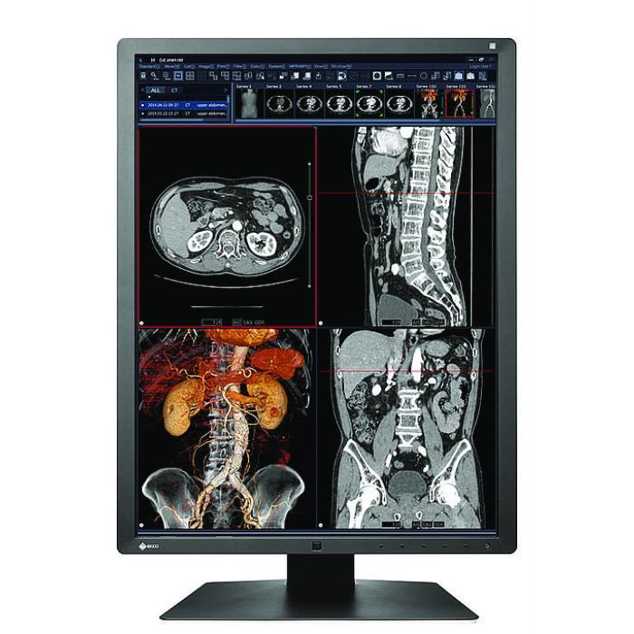 Medical monitor EIZO RadiForce RX250 2MP Color