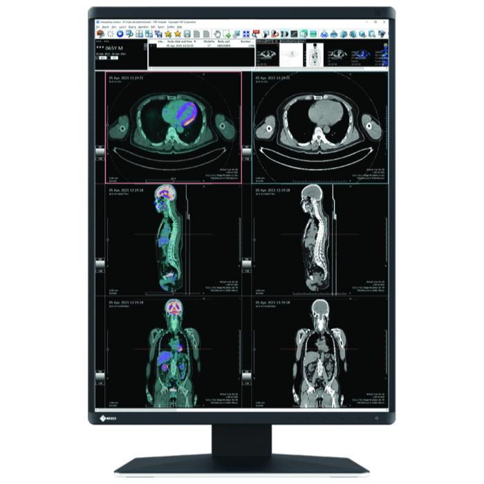 Medical monitor EIZO RadiForce RX560 5MP Color