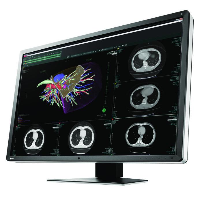 Medical monitor EIZO RadiForce RX660 6MP Color