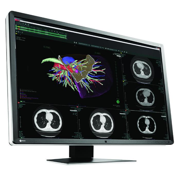 Medical monitor EIZO RadiForce RX660 6MP Color